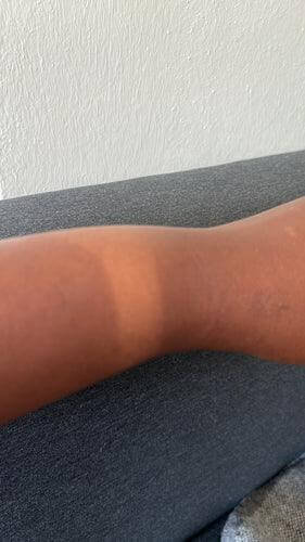 A close-up of a dark skin arm showing a tan line, illustrating the importance of sunscreen for dark skin.