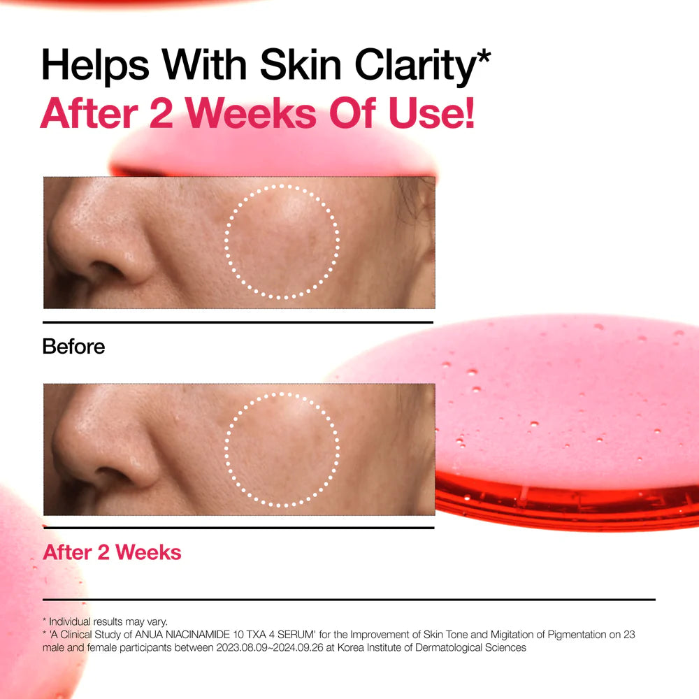 ANUA Niacinamide 10+TXA 4 Serum for dark spots