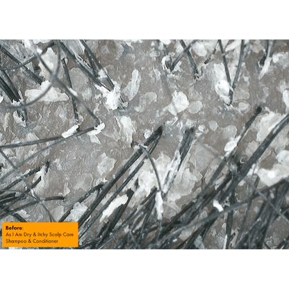 Close-up image of flaky scalp before using As I Am Dry & Itch Shampoo, highlighting scalp sensitivity issues.